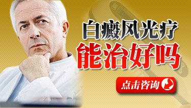 白癜风在治疗过程中好转的效果是什么样的？